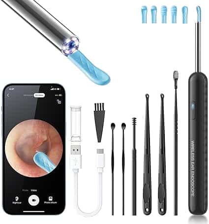 A wireless ear cleaning endoscope kit with various ear picks, cleaning tools, a USB charging cable, and a smartphone showing a live ear canal image—perfect for hygiene routines and now available with special Thursday Deals.